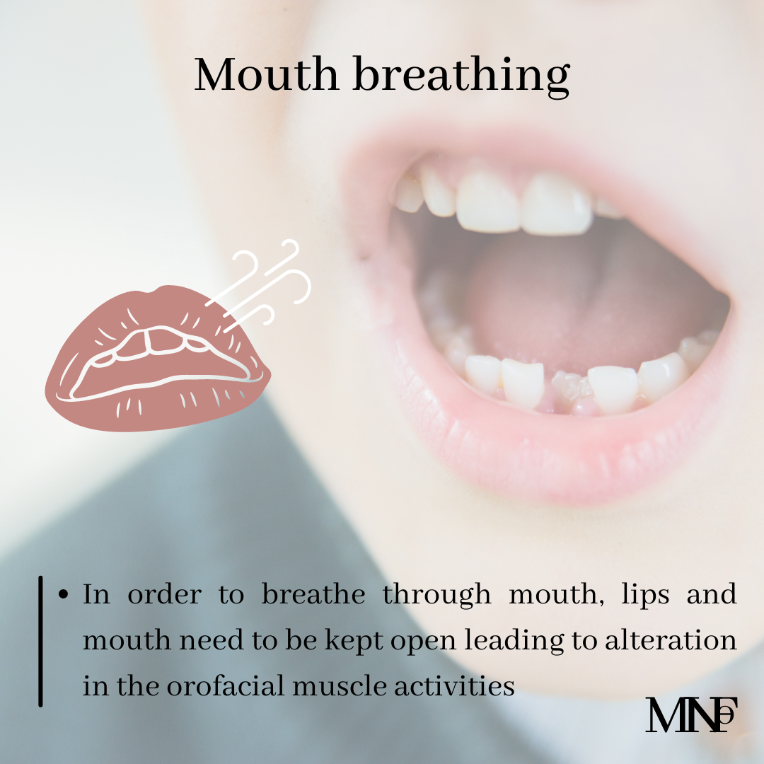 effects-of-mouth-breathing-on-orofacial-muscles-of-children