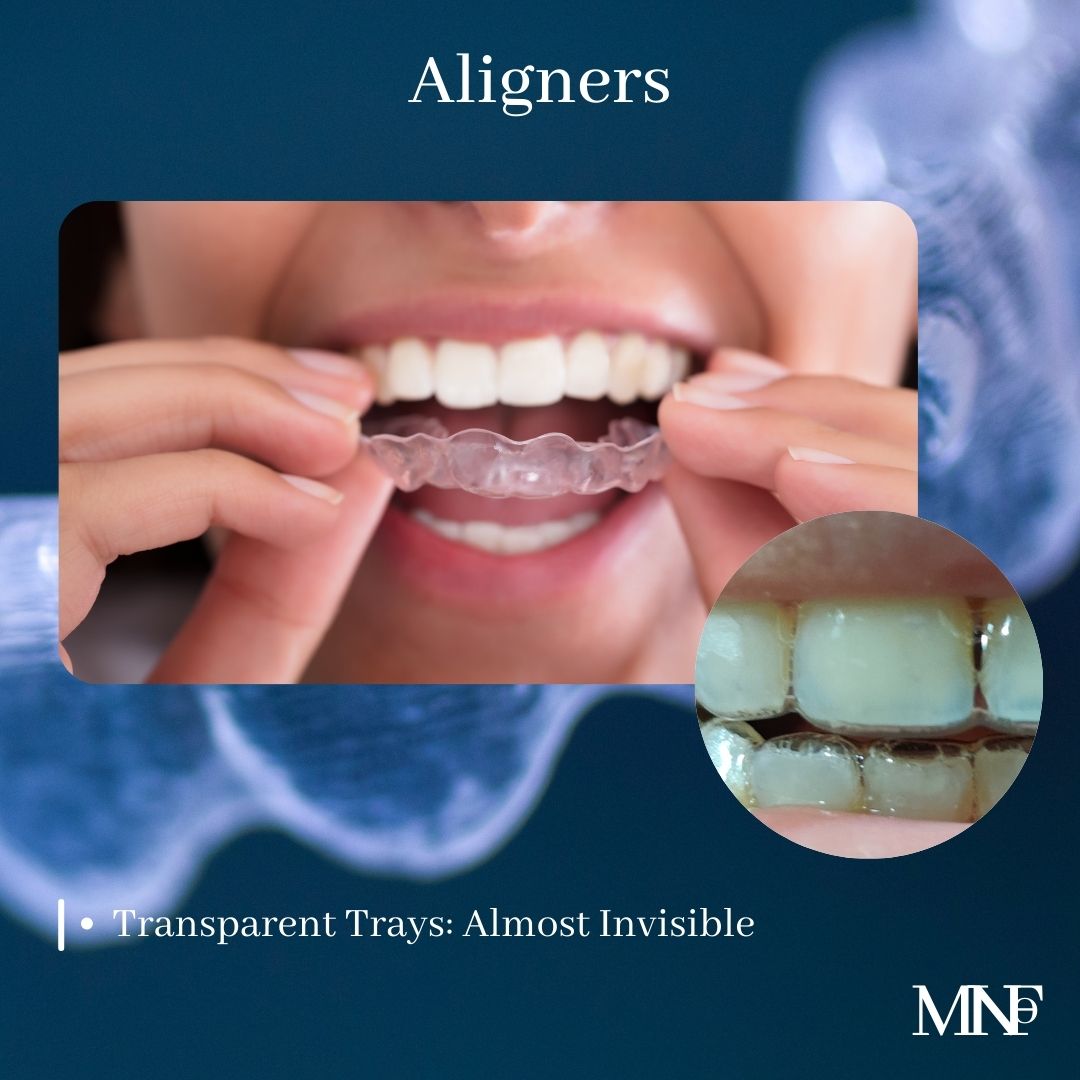 Aligners