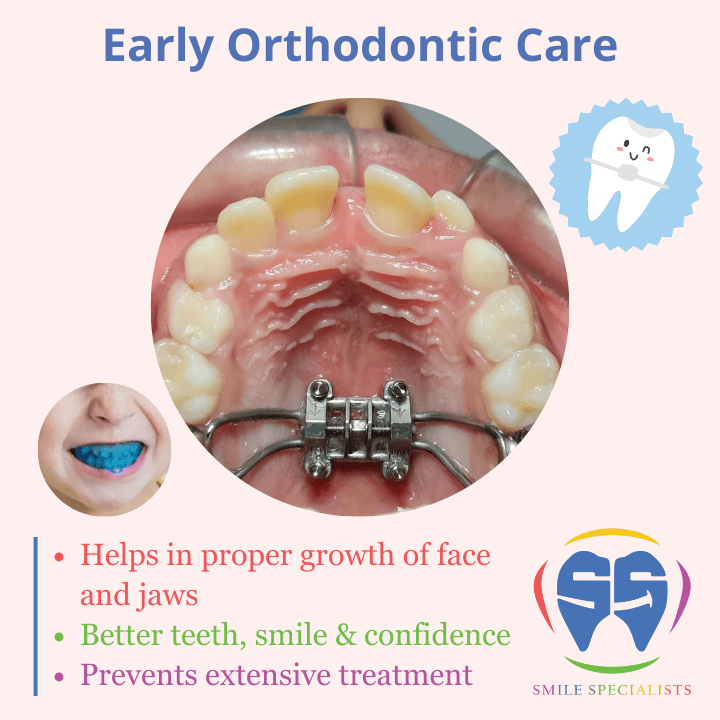 Early-Orthodontic-Care