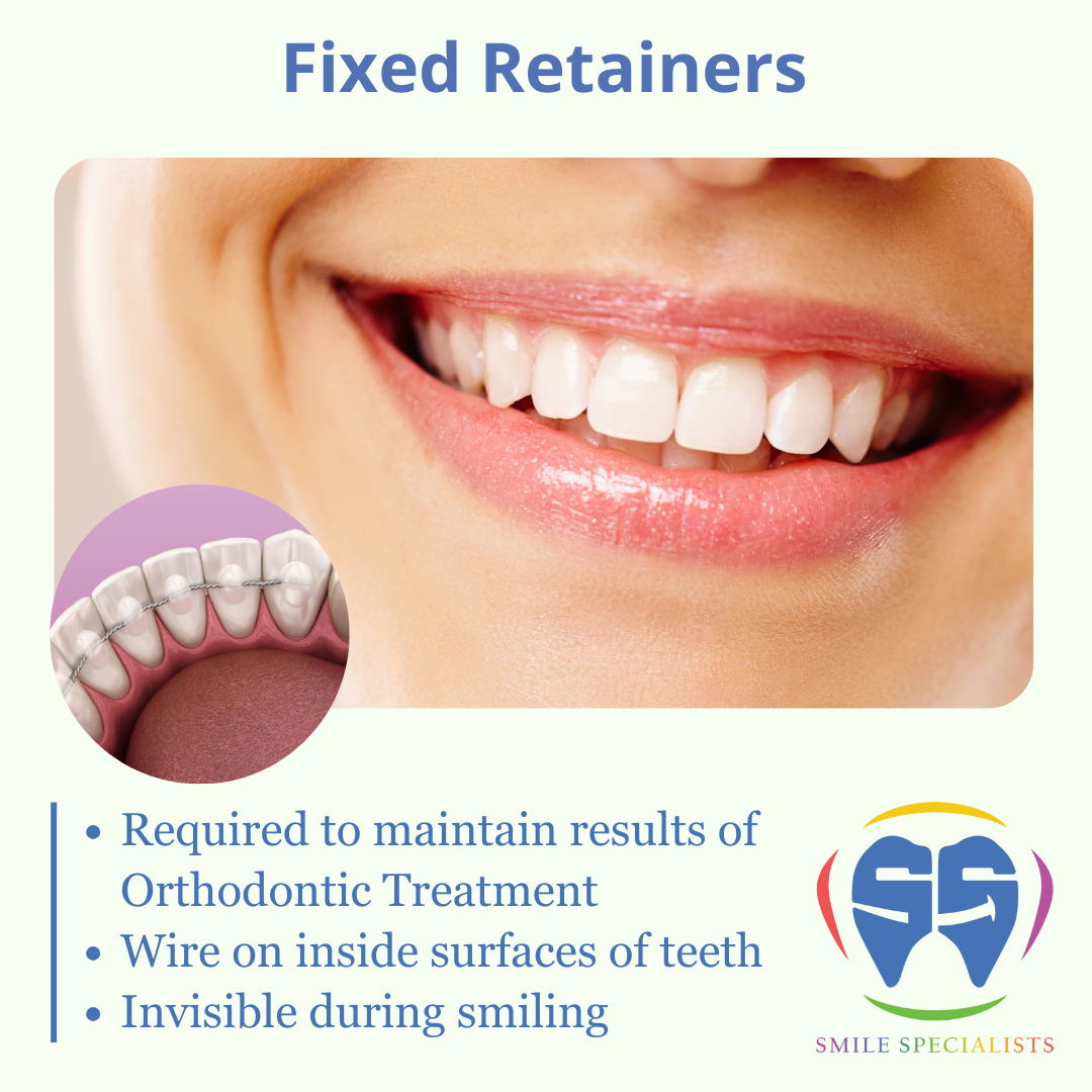 Fixed-Retainers