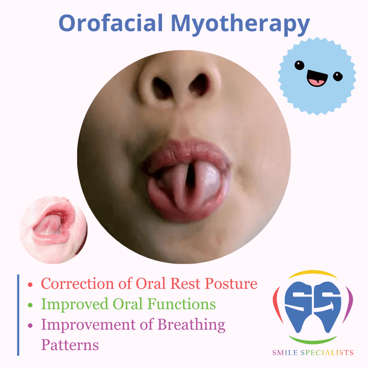 Orofacial-Myotherapy-1
