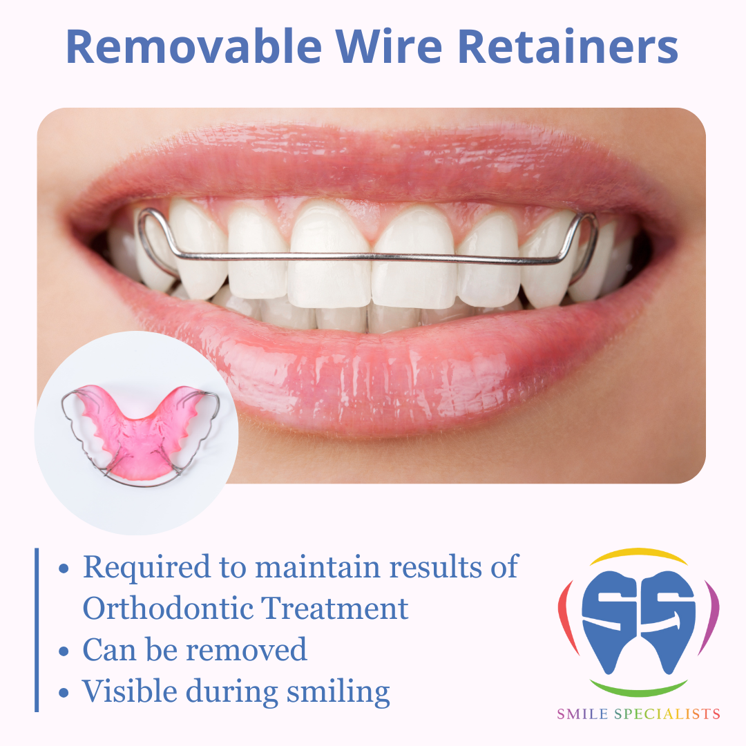Removable-Wire-Retainers